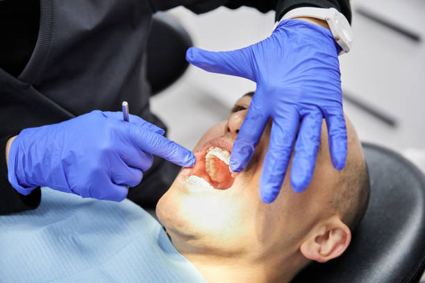 Best Emergency Denture Repair in Meron Park, CA
